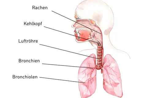 Bronchitis - © Canva 