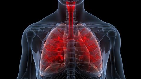 Bronchitis: Ursachen, Symptome und Behandlungsmöglichkeiten – © magicmine/stock.adobe.com