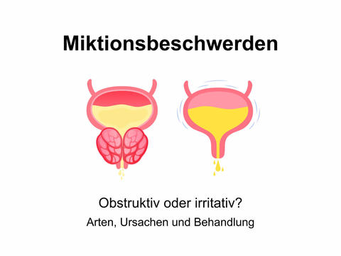 Probleme beim Wasserlassen – © Canva