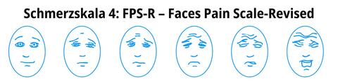 Schmerzskala 4: Faces Pain
