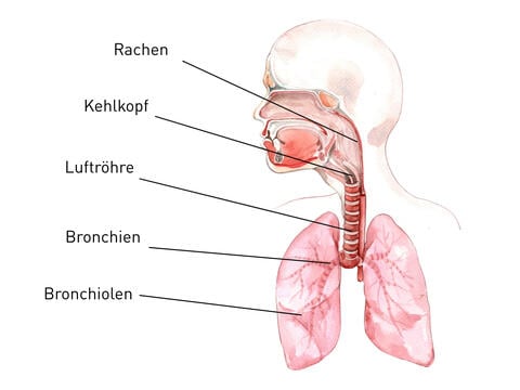 Bronchitis - © Canva 