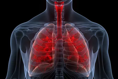 Bronchitis: Ursachen, Symptome und Behandlungsmöglichkeiten – © magicmine/stock.adobe.com