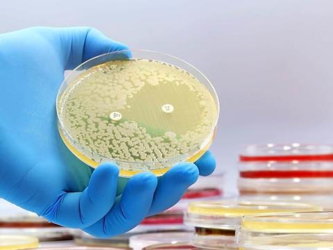 Antibiotika vs. Erreger: Was versteht man unter einer Resistenz? - © Canva