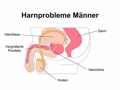 Harnprobleme Männer – © Canva
