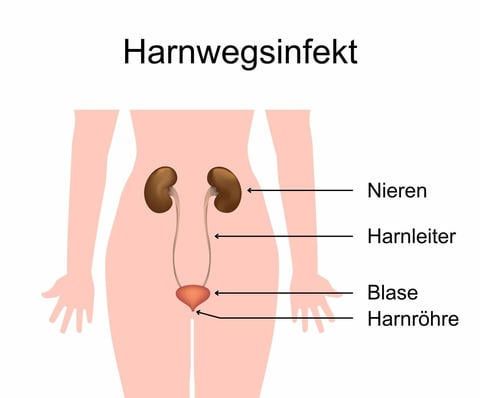 Bei einem Harwegsinfekt sind Bereiche der Harnwege entzündet - © Canva