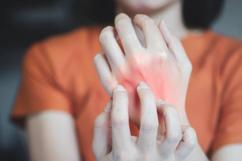 Kontaktallergie: Abwehrreaktion der Haut - © Oporty786/stock.adobe.com