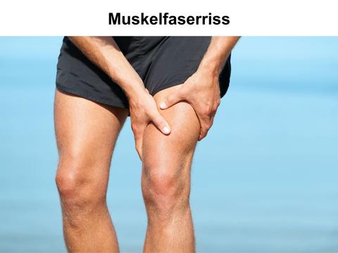 Muskelfaserriss, Sportverletzung – © Canva