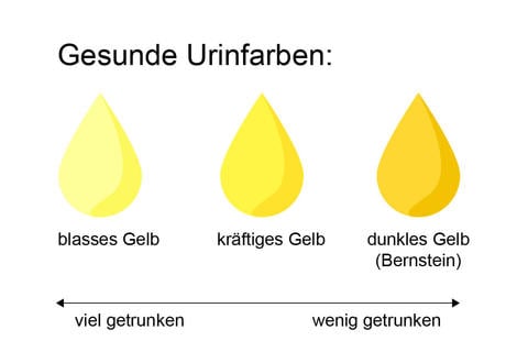 Gesunder Urin ist gelb - hell oder dunkel, abhängig von der Flüssigkeitszufuhr  - © Schwabe Austria