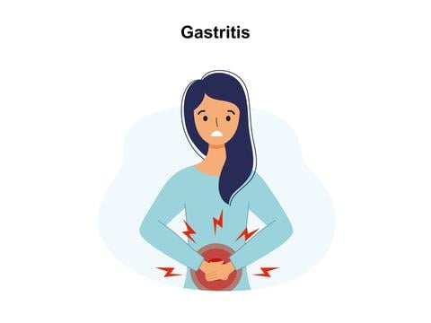 Gastritis - © Canva