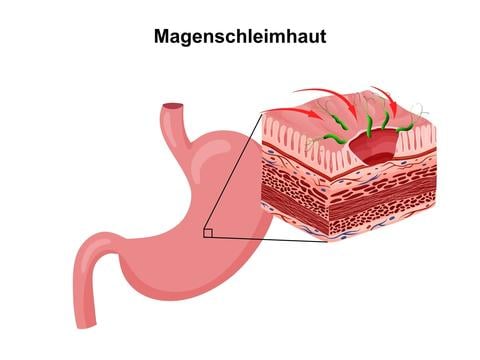 Magenschleimhaut - © Canva