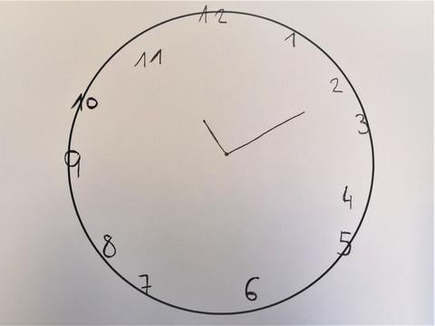 Uhrentest mit leichten visuellen Fehlern - © Schwabe Austria