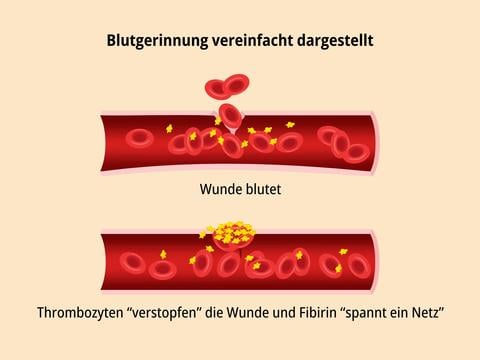 Blutgerinnung vereinfacht dargestellt - © Canva