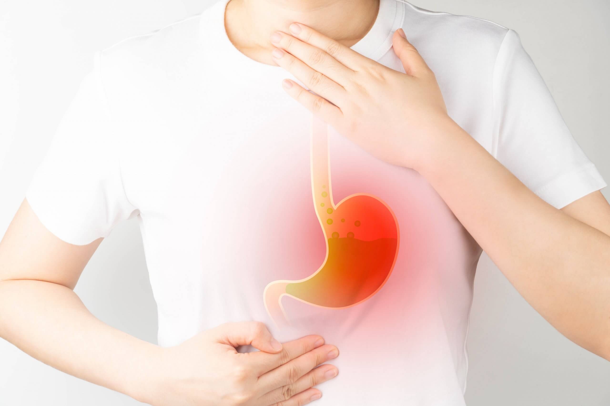Sodbrennen: Symptome – Ursachen – Behandlung | Schwabe Austria
